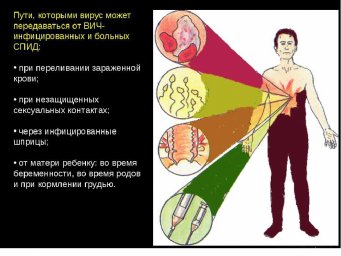 ВИЧ и СПИД